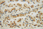 DHX36 Antibody in Immunohistochemistry (Paraffin) (IHC (P))