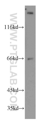 TRPV6 Antibody in Western Blot (WB)