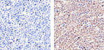 STAT5 beta Antibody in Immunohistochemistry (Paraffin) (IHC (P))