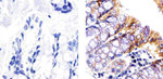 STAT5 beta Antibody in Immunohistochemistry (Paraffin) (IHC (P))