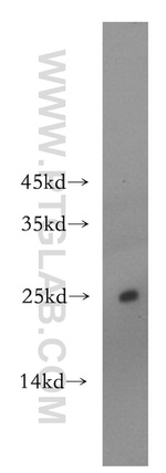 ADAT2 Antibody in Western Blot (WB)