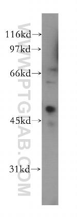 CREB3L4 Antibody in Western Blot (WB)