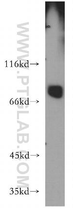LSS Antibody in Western Blot (WB)