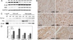 beta Catenin Antibody in Western Blot, Immunohistochemistry (WB, IHC)