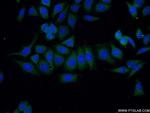 VILIP-1 Antibody in Immunocytochemistry (ICC/IF)
