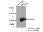 VILIP-1 Antibody in Immunoprecipitation (IP)