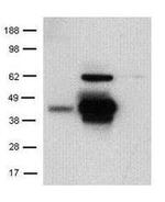 CD207 (Langerin) Antibody in Western Blot (WB)