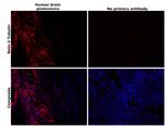 beta-3 Tubulin Antibody in Immunohistochemistry (Paraffin) (IHC (P))