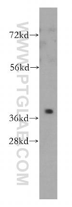 PTGR2 Antibody in Western Blot (WB)