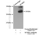 KChIP1 Antibody in Immunoprecipitation (IP)