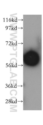 SLC38A3 Antibody in Western Blot (WB)