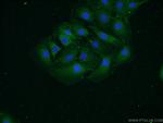 alpha N Catenin Antibody in Immunocytochemistry (ICC/IF)