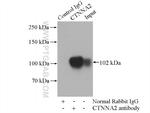 alpha N Catenin Antibody in Immunoprecipitation (IP)