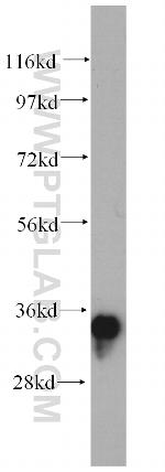 AMPK beta 2 Antibody in Western Blot (WB)