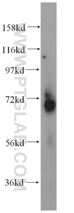 p70(S6K) Antibody in Western Blot (WB)