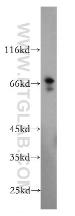 MAGEA6 Antibody in Western Blot (WB)