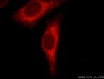 PPP1R15B Antibody in Immunocytochemistry (ICC/IF)