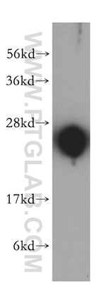 IgG light chain (Kappa) Antibody in Western Blot (WB)