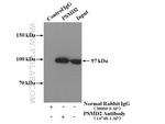PSMD2 Antibody in Immunoprecipitation (IP)