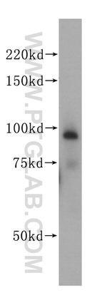 PSMD2 Antibody in Western Blot (WB)