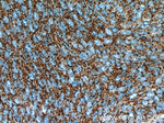 NDUFB7 Antibody in Immunohistochemistry (Paraffin) (IHC (P))
