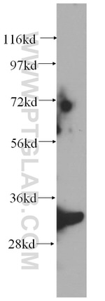 SCGN Antibody in Western Blot (WB)