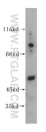 GALNS Antibody in Western Blot (WB)
