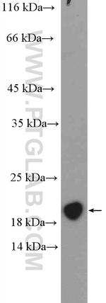 MCTS1 Antibody in Western Blot (WB)