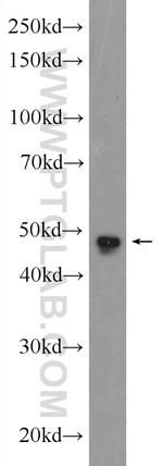 SKP2 Antibody in Western Blot (WB)