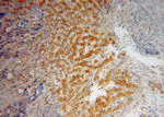 PHKG2 Antibody in Immunohistochemistry (Paraffin) (IHC (P))