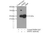 DHFR Antibody in Immunoprecipitation (IP)