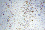 KAP1 Antibody in Immunohistochemistry (Paraffin) (IHC (P))
