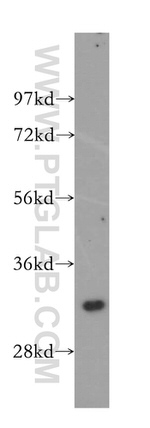 GEMIN8 Antibody in Western Blot (WB)