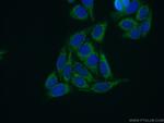 MRPL11 Antibody in Immunocytochemistry (ICC/IF)