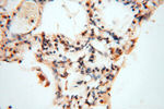 MRPL11 Antibody in Immunohistochemistry (Paraffin) (IHC (P))