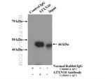 ATXN10 Antibody in Immunoprecipitation (IP)