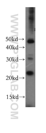 PSMB3 Antibody in Western Blot (WB)