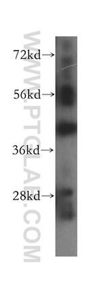Syntaxin 18 Antibody in Western Blot (WB)