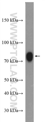 ACSBG1 Antibody in Western Blot (WB)