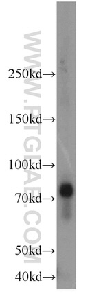 OCTN2 Antibody in Western Blot (WB)