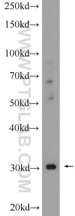 CHST8 Antibody in Western Blot (WB)