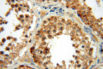 MRPL46 Antibody in Immunohistochemistry (Paraffin) (IHC (P))