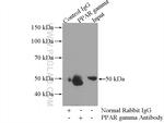 PPAR gamma Antibody in Immunoprecipitation (IP)