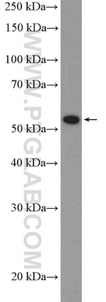 PPAR gamma Antibody in Western Blot (WB)