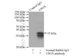 CPOX Antibody in Immunoprecipitation (IP)