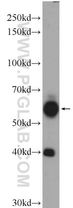 N4BP3 Antibody in Western Blot (WB)