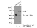 SRF Antibody in Immunoprecipitation (IP)