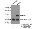 VPS33A Antibody in Immunoprecipitation (IP)