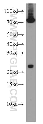 ARL6IP6 Antibody in Western Blot (WB)