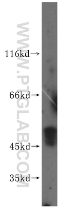PNMAL1 Antibody in Western Blot (WB)